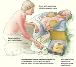 Illustration showing a typical setup using an automated external defibrillator (AED). The AED has step-by-step instructions and voice prompts that enable an untrained bystander to use the machine properly.