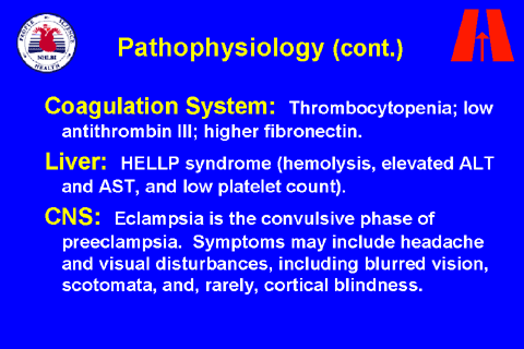 slide 17