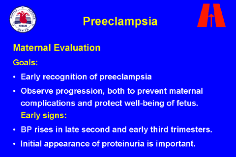 slide 31