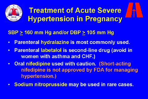 slide 38